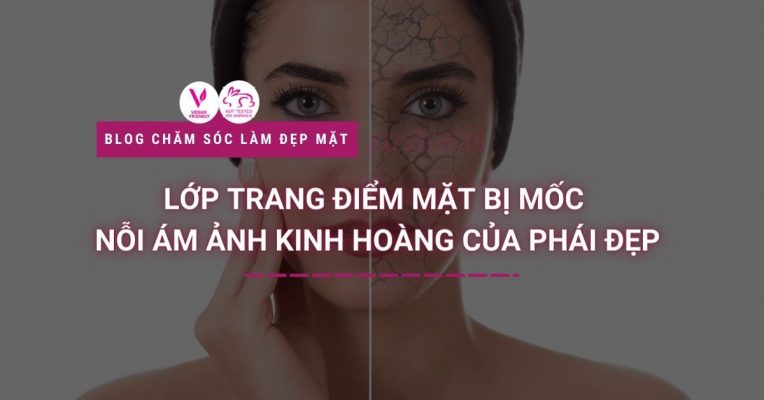 Lop Trang Diem Mat Bi Moc Noi Am Anh Kinh Hoang Cua Phai Dep