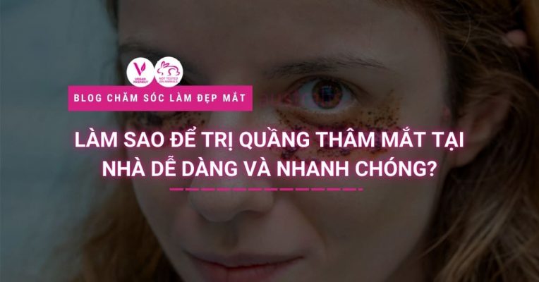 Làm Sao Để Trị Quầng Thâm Mắt Tại Nhà Dễ Dàng Và Nhanh Chóng